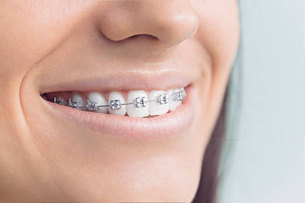 Best Laser Dentistry  in Marksville, LA